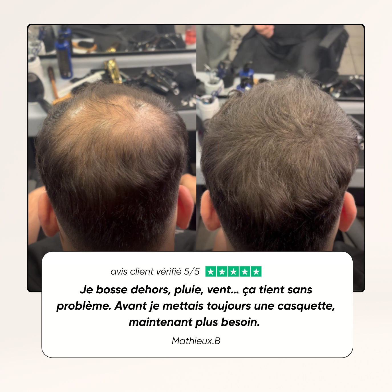 Hair camouflage