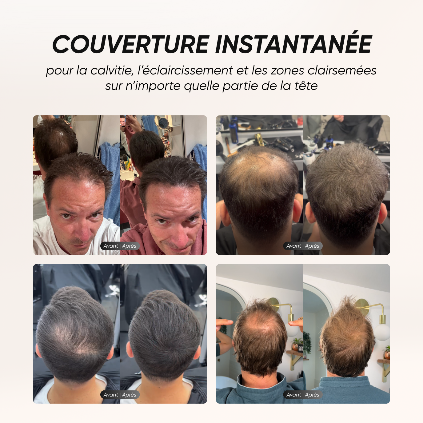 Hair camouflage