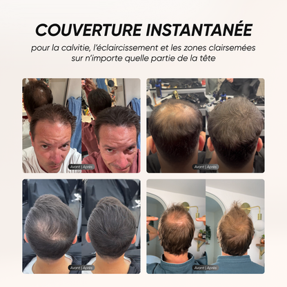 Hair camouflage