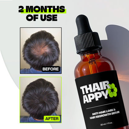 Hair Regrowth & Anti-Hair Loss Serum