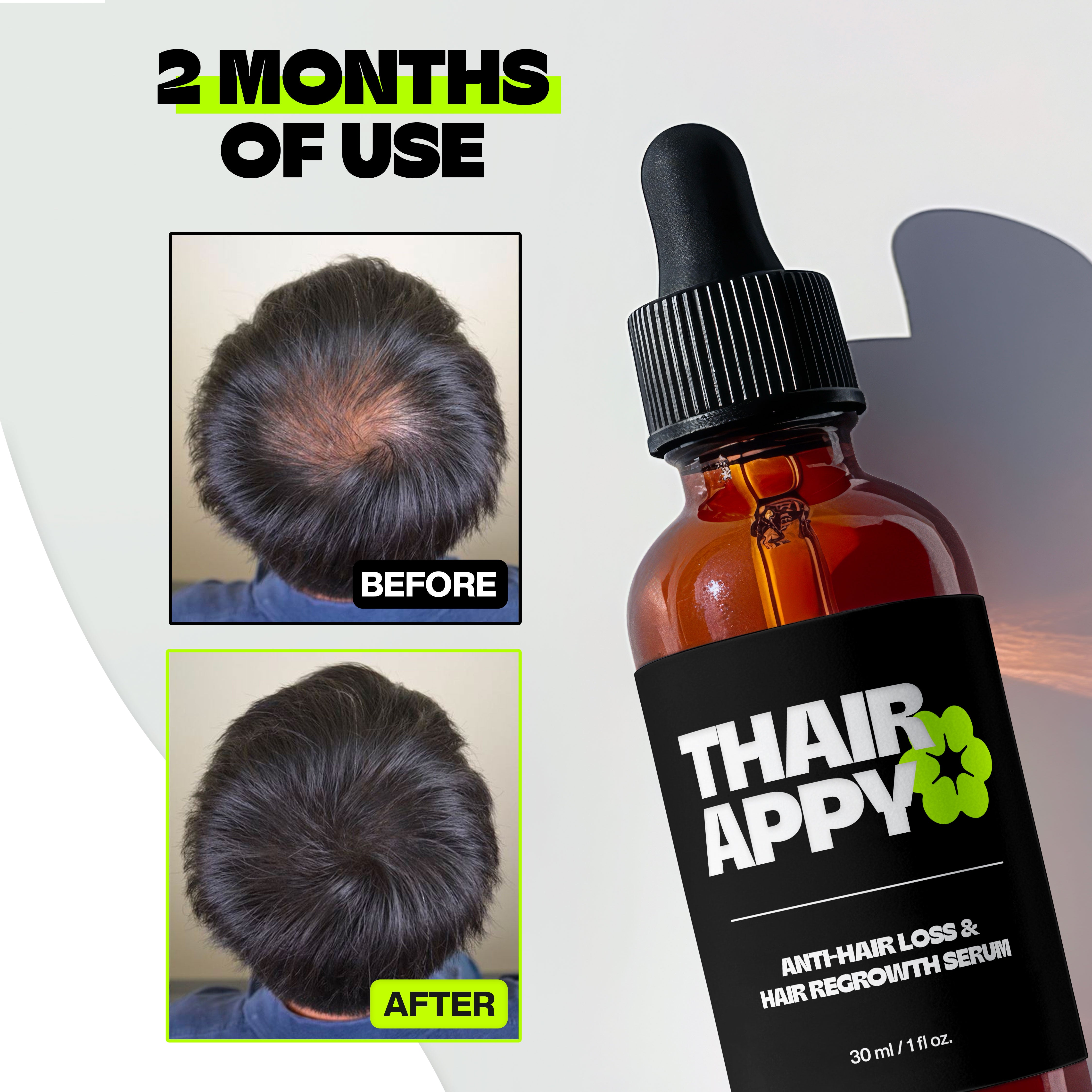 Hair Regrowth & Anti-Hair Loss Serum