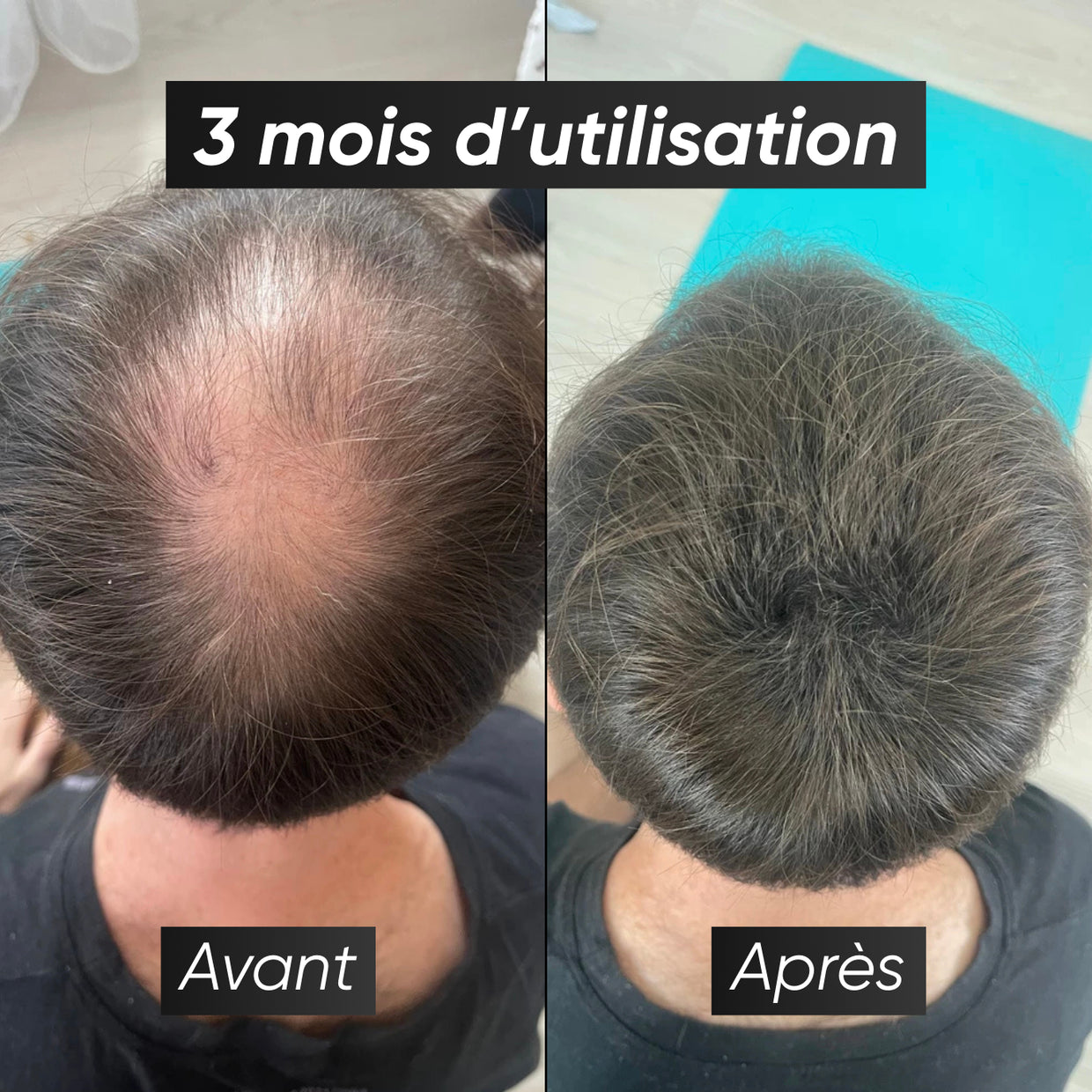 Hair Regrowth & Anti-Hair Loss Serum